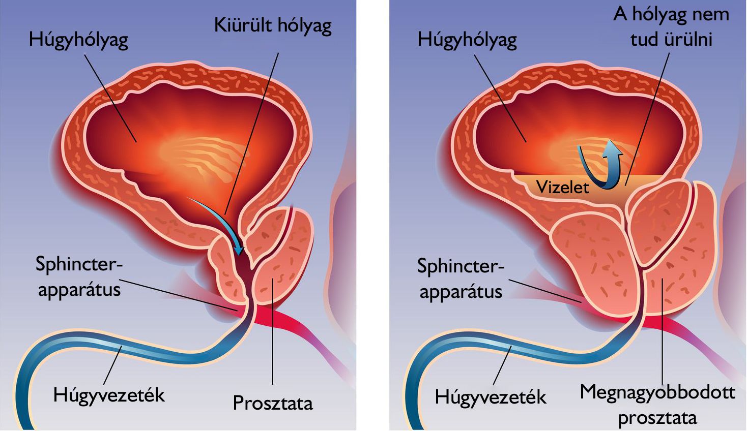 miért jelenik meg a prosztatitis prostatitis fájdalom a jobb oldalon