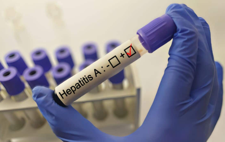 Fehérvár Médiacentrum fotója